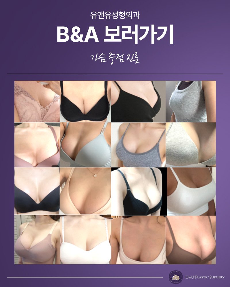 가슴수술 원스톱 검사